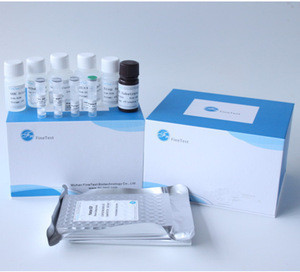 Reaserch Use Human Ca-125(carbohydrate Antigen 125) Elisa Kit ...